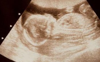 新生儿用赫根奶瓶怎么样呢？有哪些优势？