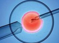 广州三代试管婴儿费用总共多少钱？钱都花在哪里了？