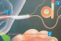 2026济南本地有资质的正规试管婴儿机构有哪些？